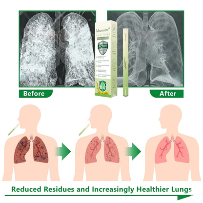 🇨🇦 𝐏𝐫𝐨𝐮𝐝𝐥𝐲 𝐂𝐚𝐧𝐚𝐝𝐢𝐚𝐧 𝗠𝗮𝗱𝗲 & 𝑺𝒉𝒊𝒑𝒑𝒆𝒅✅𝐌𝐮𝐫𝐰𝒐𝒏® 𝐁𝐨𝐭𝐚𝐧𝐢𝐜𝐚𝐥 𝐌𝐮𝐥𝐥𝐞𝐢𝐧 𝐋𝐮𝐧𝐠 𝐂𝐥𝐞𝐚𝐧𝐬𝐞 𝐃𝐢𝐟𝐟𝐮𝐬𝐞𝐫🔥(👨‍⚕️Cough, Pharyngitis, shortness of breath, sputum, stuffy nose, bronchitis, bronchitis, allergy symptoms, lung discomfort)3❤️