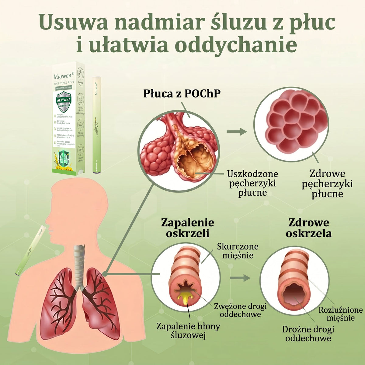 🇵🇱 𝐖𝐲𝐬𝐨𝐤𝐢𝐞𝐣 𝐣𝐚𝐤𝐨ś𝐜𝐢 𝐩𝐨𝐥𝐬𝐤𝐢 𝐩𝐫𝐨𝐝𝐮𝐤𝐭, 𝒘𝒚𝒔𝒚ł𝒌𝒂 𝒛 𝒌𝒓𝒂𝒋𝒖✅𝐙𝐢𝐨ł𝐨𝐰𝐲 𝐰𝐚𝐩𝐨𝐫𝐲𝐳𝐚𝐭𝐨𝐫 𝐝𝐨 𝐩ł𝐮𝐜 𝐌𝐮𝐫𝐰𝐨𝐧® (👨‍⚕️ 𝐒𝐤𝐮𝐭𝐞𝐜𝐳𝐧𝐲 𝐧𝐚: 𝐤𝐚𝐬𝐳𝐞𝐥, 𝐝𝐮𝐬𝐳𝐧𝐨ś𝐜𝐢, 𝐟𝐥𝐞𝐠𝐦ę, 𝐳𝐚𝐭𝐤𝐚𝐧𝐲 𝐧𝐨𝐬, 𝐳𝐚𝐩𝐚𝐥𝐞𝐧𝐢𝐞 𝐨𝐬𝐤𝐫𝐳𝐞𝐥𝐢, 𝐚𝐥𝐞𝐫𝐠𝐢ę 𝐢 𝐩𝐫𝐨𝐛𝐥𝐞𝐦𝐲 𝐳 𝐩ł𝐮𝐜𝐚𝐦𝐢)1💖