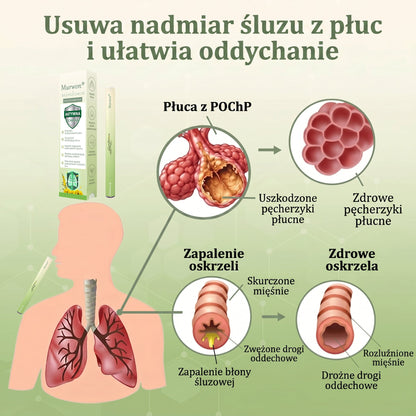 🇵🇱 𝐖𝐲𝐬𝐨𝐤𝐢𝐞𝐣 𝐣𝐚𝐤𝐨ś𝐜𝐢 𝐩𝐨𝐥𝐬𝐤𝐢 𝐩𝐫𝐨𝐝𝐮𝐤𝐭, 𝒘𝒚𝒔𝒚ł𝒌𝒂 𝒛 𝒌𝒓𝒂𝒋𝒖✅𝐙𝐢𝐨ł𝐨𝐰𝐲 𝐰𝐚𝐩𝐨𝐫𝐲𝐳𝐚𝐭𝐨𝐫 𝐝𝐨 𝐩ł𝐮𝐜 𝐌𝐮𝐫𝐰𝐨𝐧® (👨‍⚕️ 𝐒𝐤𝐮𝐭𝐞𝐜𝐳𝐧𝐲 𝐧𝐚: 𝐤𝐚𝐬𝐳𝐞𝐥, 𝐝𝐮𝐬𝐳𝐧𝐨ś𝐜𝐢, 𝐟𝐥𝐞𝐠𝐦ę, 𝐳𝐚𝐭𝐤𝐚𝐧𝐲 𝐧𝐨𝐬, 𝐳𝐚𝐩𝐚𝐥𝐞𝐧𝐢𝐞 𝐨𝐬𝐤𝐫𝐳𝐞𝐥𝐢, 𝐚𝐥𝐞𝐫𝐠𝐢ę 𝐢 𝐩𝐫𝐨𝐛𝐥𝐞𝐦𝐲 𝐳 𝐩ł𝐮𝐜𝐚𝐦𝐢)1💖