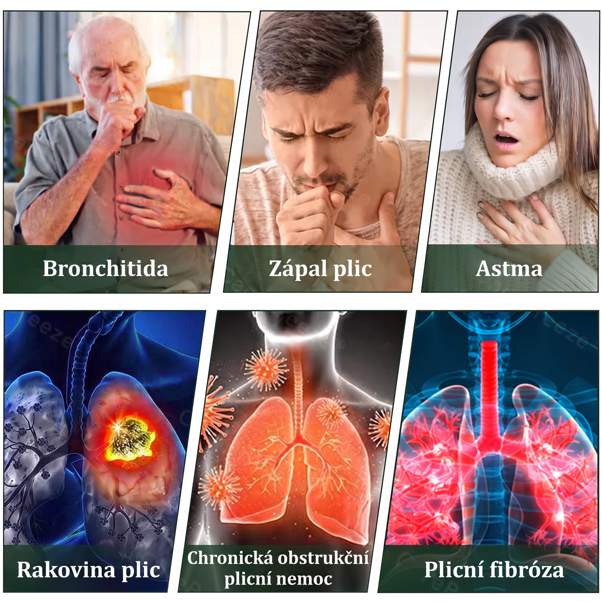 𝐎𝐟𝐢𝐜𝐢á𝐥𝐧í 𝐞-𝐬𝐡𝐨𝐩✅ 𝐌𝐮𝐫𝐰𝐨𝐧® 𝐛𝐲𝐥𝐢𝐧𝐧ý 𝐢𝐧𝐡𝐚𝐥á𝐭𝐨𝐫 𝐩𝐫𝐨 𝐨č𝐢𝐬𝐭𝐮 𝐩𝐥𝐢𝐜(👨‍⚕️ Úč𝐢𝐧𝐧á 𝐩𝐨𝐦𝐨𝐜 𝐩ř𝐢: 𝐤𝐚š𝐥𝐢, 𝐛𝐨𝐥𝐞𝐬𝐭𝐢 𝐯 𝐤𝐫𝐤𝐮, 𝐝𝐮š𝐧𝐨𝐬𝐭𝐢, 𝐳𝐚𝐡𝐥𝐞𝐧ě𝐧í, 𝐮𝐜𝐩𝐚𝐧é𝐦 𝐧𝐨𝐬𝐮, 𝐳á𝐧ě𝐭𝐮 𝐩𝐫ů𝐝𝐮š𝐞𝐤, 𝐚𝐥𝐞𝐫𝐠𝐢𝐜𝐤ý𝐜𝐡 𝐩ří𝐳𝐧𝐚𝐜í𝐜𝐡 𝐚 𝐩𝐥𝐢𝐜𝐧í𝐜𝐡 𝐩𝐨𝐭íží𝐜𝐡)𝟏💝