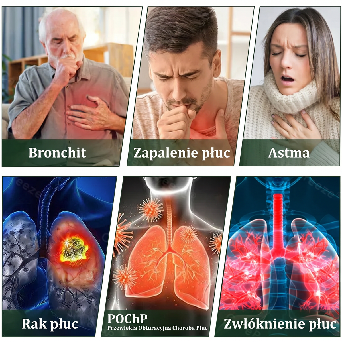 🇵🇱 𝐖𝐲𝐬𝐨𝐤𝐢𝐞𝐣 𝐣𝐚𝐤𝐨ś𝐜𝐢 𝐩𝐨𝐥𝐬𝐤𝐢 𝐩𝐫𝐨𝐝𝐮𝐤𝐭, 𝒘𝒚𝒔𝒚ł𝒌𝒂 𝒛 𝒌𝒓𝒂𝒋𝒖✅𝐙𝐢𝐨ł𝐨𝐰𝐲 𝐰𝐚𝐩𝐨𝐫𝐲𝐳𝐚𝐭𝐨𝐫 𝐝𝐨 𝐩ł𝐮𝐜 𝐌𝐮𝐫𝐰𝐨𝐧® (👨‍⚕️ 𝐒𝐤𝐮𝐭𝐞𝐜𝐳𝐧𝐲 𝐧𝐚: 𝐤𝐚𝐬𝐳𝐞𝐥, 𝐝𝐮𝐬𝐳𝐧𝐨ś𝐜𝐢, 𝐟𝐥𝐞𝐠𝐦ę, 𝐳𝐚𝐭𝐤𝐚𝐧𝐲 𝐧𝐨𝐬, 𝐳𝐚𝐩𝐚𝐥𝐞𝐧𝐢𝐞 𝐨𝐬𝐤𝐫𝐳𝐞𝐥𝐢, 𝐚𝐥𝐞𝐫𝐠𝐢ę 𝐢 𝐩𝐫𝐨𝐛𝐥𝐞𝐦𝐲 𝐳 𝐩ł𝐮𝐜𝐚𝐦𝐢)1💖