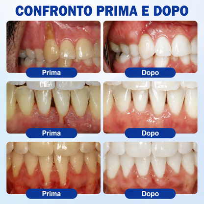 𝐂𝐞𝐫𝐭𝐢𝐟𝐢𝐜𝐚𝐭𝐨 𝐝𝐚 𝐎𝐝𝐨𝐧𝐭𝐨𝐢𝐚𝐭𝐫𝐢✨𝑽𝐢𝘁𝒂𝒍𝒊𝒔𝒚𝒔®🦷𝑮𝒖𝒎𝑹𝒆𝒗𝒊𝒗𝒆 𝑮𝒆𝒍 𝑷𝒂𝒓𝒐𝒅𝒐𝒏𝒕𝒂𝒍𝒆 𝑹𝒊𝒈𝒆𝒏𝒆𝒓𝒂𝒏𝒕𝒆🥜