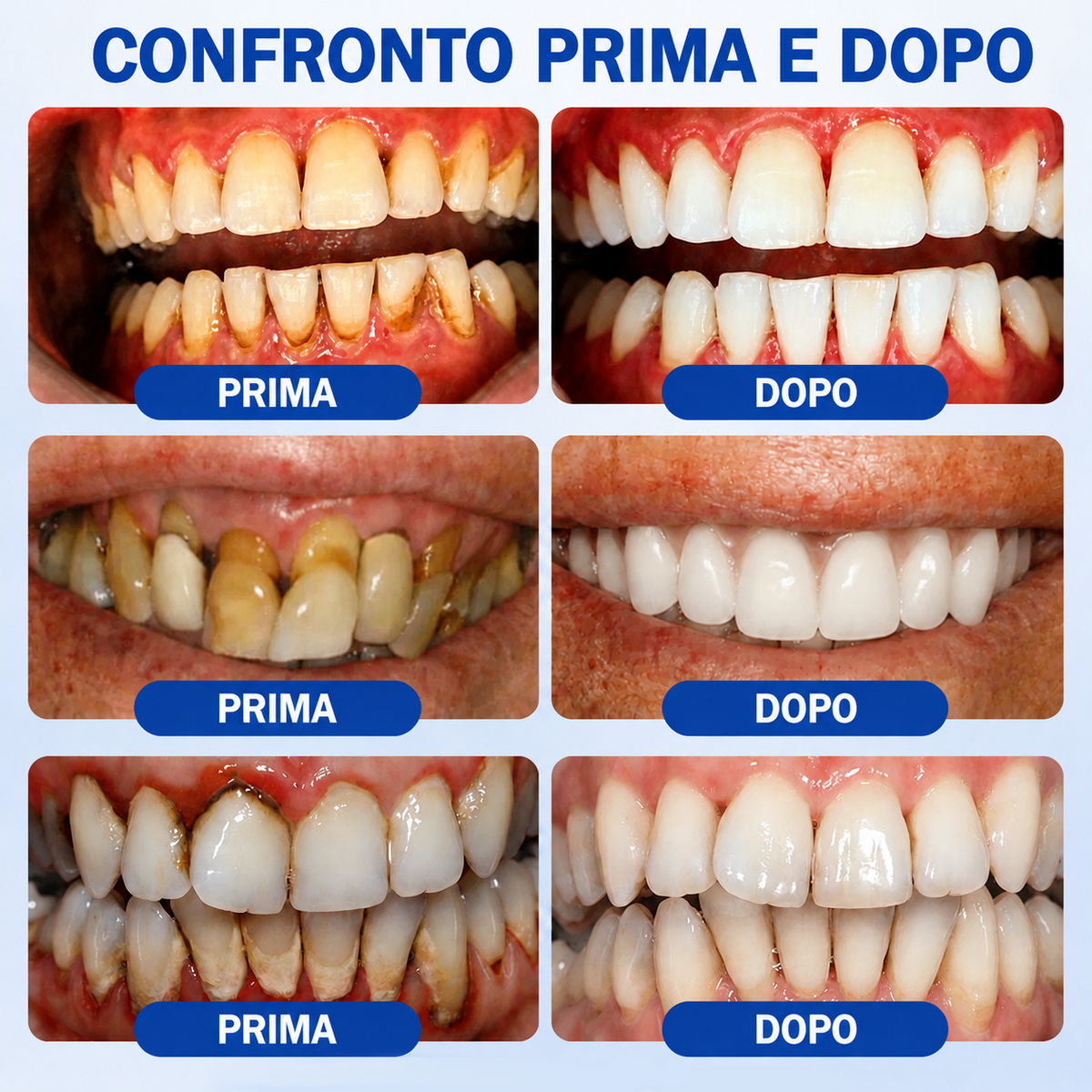 𝐂𝐞𝐫𝐭𝐢𝐟𝐢𝐜𝐚𝐭𝐨 𝐝𝐚 𝐎𝐝𝐨𝐧𝐭𝐨𝐢𝐚𝐭𝐫𝐢✨𝑽𝐢𝘁𝒂𝒍𝒊𝒔𝒚𝒔®🦷𝑮𝒖𝒎𝑹𝒆𝒗𝒊𝒗𝒆 𝑮𝒆𝒍 𝑷𝒂𝒓𝒐𝒅𝒐𝒏𝒕𝒂𝒍𝒆 𝑹𝒊𝒈𝒆𝒏𝒆𝒓𝒂𝒏𝒕𝒆🥜