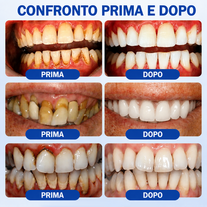 𝐂𝐞𝐫𝐭𝐢𝐟𝐢𝐜𝐚𝐭𝐨 𝐝𝐚 𝐎𝐝𝐨𝐧𝐭𝐨𝐢𝐚𝐭𝐫𝐢✨𝑽𝐢𝘁𝒂𝒍𝒊𝒔𝒚𝒔®🦷𝑮𝒖𝒎𝑹𝒆𝒗𝒊𝒗𝒆 𝑮𝒆𝒍 𝑷𝒂𝒓𝒐𝒅𝒐𝒏𝒕𝒂𝒍𝒆 𝑹𝒊𝒈𝒆𝒏𝒆𝒓𝒂𝒏𝒕𝒆🥜