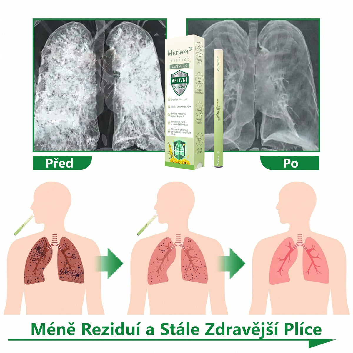 𝐎𝐟𝐢𝐜𝐢á𝐥𝐧í 𝐞-𝐬𝐡𝐨𝐩✅ 𝐌𝐮𝐫𝐰𝐨𝐧® 𝐛𝐲𝐥𝐢𝐧𝐧ý 𝐢𝐧𝐡𝐚𝐥á𝐭𝐨𝐫 𝐩𝐫𝐨 𝐨č𝐢𝐬𝐭𝐮 𝐩𝐥𝐢𝐜(👨‍⚕️ Úč𝐢𝐧𝐧á 𝐩𝐨𝐦𝐨𝐜 𝐩ř𝐢: 𝐤𝐚š𝐥𝐢, 𝐛𝐨𝐥𝐞𝐬𝐭𝐢 𝐯 𝐤𝐫𝐤𝐮, 𝐝𝐮š𝐧𝐨𝐬𝐭𝐢, 𝐳𝐚𝐡𝐥𝐞𝐧ě𝐧í, 𝐮𝐜𝐩𝐚𝐧é𝐦 𝐧𝐨𝐬𝐮, 𝐳á𝐧ě𝐭𝐮 𝐩𝐫ů𝐝𝐮š𝐞𝐤, 𝐚𝐥𝐞𝐫𝐠𝐢𝐜𝐤ý𝐜𝐡 𝐩ří𝐳𝐧𝐚𝐜í𝐜𝐡 𝐚 𝐩𝐥𝐢𝐜𝐧í𝐜𝐡 𝐩𝐨𝐭íží𝐜𝐡)𝟏💝