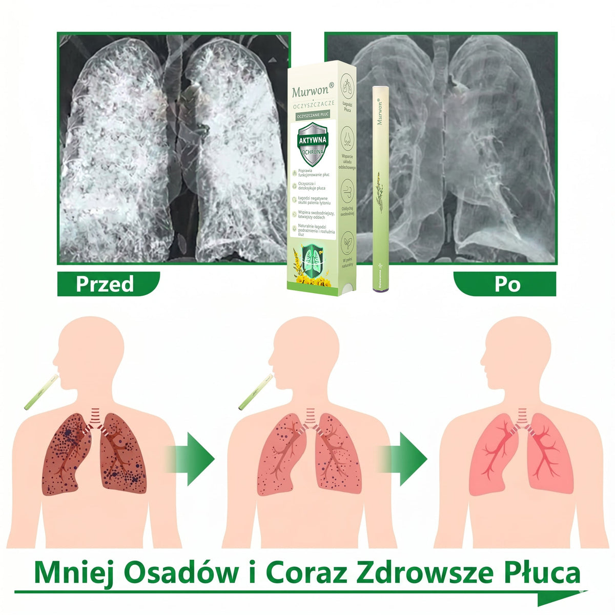 🇵🇱 𝐖𝐲𝐬𝐨𝐤𝐢𝐞𝐣 𝐣𝐚𝐤𝐨ś𝐜𝐢 𝐩𝐨𝐥𝐬𝐤𝐢 𝐩𝐫𝐨𝐝𝐮𝐤𝐭, 𝒘𝒚𝒔𝒚ł𝒌𝒂 𝒛 𝒌𝒓𝒂𝒋𝒖✅𝐙𝐢𝐨ł𝐨𝐰𝐲 𝐰𝐚𝐩𝐨𝐫𝐲𝐳𝐚𝐭𝐨𝐫 𝐝𝐨 𝐩ł𝐮𝐜 𝐌𝐮𝐫𝐰𝐨𝐧® (👨‍⚕️ 𝐒𝐤𝐮𝐭𝐞𝐜𝐳𝐧𝐲 𝐧𝐚: 𝐤𝐚𝐬𝐳𝐞𝐥, 𝐝𝐮𝐬𝐳𝐧𝐨ś𝐜𝐢, 𝐟𝐥𝐞𝐠𝐦ę, 𝐳𝐚𝐭𝐤𝐚𝐧𝐲 𝐧𝐨𝐬, 𝐳𝐚𝐩𝐚𝐥𝐞𝐧𝐢𝐞 𝐨𝐬𝐤𝐫𝐳𝐞𝐥𝐢, 𝐚𝐥𝐞𝐫𝐠𝐢ę 𝐢 𝐩𝐫𝐨𝐛𝐥𝐞𝐦𝐲 𝐳 𝐩ł𝐮𝐜𝐚𝐦𝐢)1💖