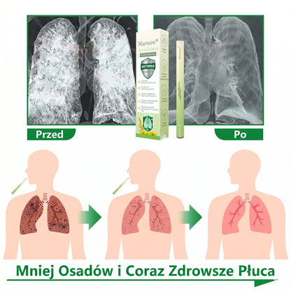 🇵🇱 𝐖𝐲𝐬𝐨𝐤𝐢𝐞𝐣 𝐣𝐚𝐤𝐨ś𝐜𝐢 𝐩𝐨𝐥𝐬𝐤𝐢 𝐩𝐫𝐨𝐝𝐮𝐤𝐭, 𝒘𝒚𝒔𝒚ł𝒌𝒂 𝒛 𝒌𝒓𝒂𝒋𝒖✅𝐙𝐢𝐨ł𝐨𝐰𝐲 𝐰𝐚𝐩𝐨𝐫𝐲𝐳𝐚𝐭𝐨𝐫 𝐝𝐨 𝐩ł𝐮𝐜 𝐌𝐮𝐫𝐰𝐨𝐧® (👨‍⚕️ 𝐒𝐤𝐮𝐭𝐞𝐜𝐳𝐧𝐲 𝐧𝐚: 𝐤𝐚𝐬𝐳𝐞𝐥, 𝐝𝐮𝐬𝐳𝐧𝐨ś𝐜𝐢, 𝐟𝐥𝐞𝐠𝐦ę, 𝐳𝐚𝐭𝐤𝐚𝐧𝐲 𝐧𝐨𝐬, 𝐳𝐚𝐩𝐚𝐥𝐞𝐧𝐢𝐞 𝐨𝐬𝐤𝐫𝐳𝐞𝐥𝐢, 𝐚𝐥𝐞𝐫𝐠𝐢ę 𝐢 𝐩𝐫𝐨𝐛𝐥𝐞𝐦𝐲 𝐳 𝐩ł𝐮𝐜𝐚𝐦𝐢)1💖