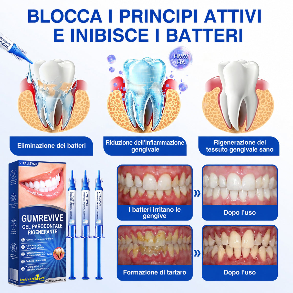 𝐂𝐞𝐫𝐭𝐢𝐟𝐢𝐜𝐚𝐭𝐨 𝐝𝐚 𝐎𝐝𝐨𝐧𝐭𝐨𝐢𝐚𝐭𝐫𝐢✨𝑽𝐢𝘁𝒂𝒍𝒊𝒔𝒚𝒔®🦷𝑮𝒖𝒎𝑹𝒆𝒗𝒊𝒗𝒆 𝑮𝒆𝒍 𝑷𝒂𝒓𝒐𝒅𝒐𝒏𝒕𝒂𝒍𝒆 𝑹𝒊𝒈𝒆𝒏𝒆𝒓𝒂𝒏𝒕𝒆🥜