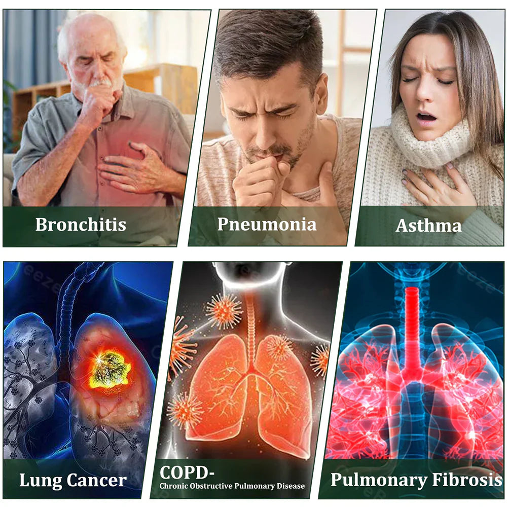 🇨🇦 𝐏𝐫𝐨𝐮𝐝𝐥𝐲 𝐂𝐚𝐧𝐚𝐝𝐢𝐚𝐧 𝗠𝗮𝗱𝗲 & 𝑺𝒉𝒊𝒑𝒑𝒆𝒅✅𝐌𝐮𝐫𝐰𝒐𝒏® 𝐁𝐨𝐭𝐚𝐧𝐢𝐜𝐚𝐥 𝐌𝐮𝐥𝐥𝐞𝐢𝐧 𝐋𝐮𝐧𝐠 𝐂𝐥𝐞𝐚𝐧𝐬𝐞 𝐃𝐢𝐟𝐟𝐮𝐬𝐞𝐫🔥(👨‍⚕️Cough, Pharyngitis, shortness of breath, sputum, stuffy nose, bronchitis, bronchitis, allergy symptoms, lung discomfort)3❤️